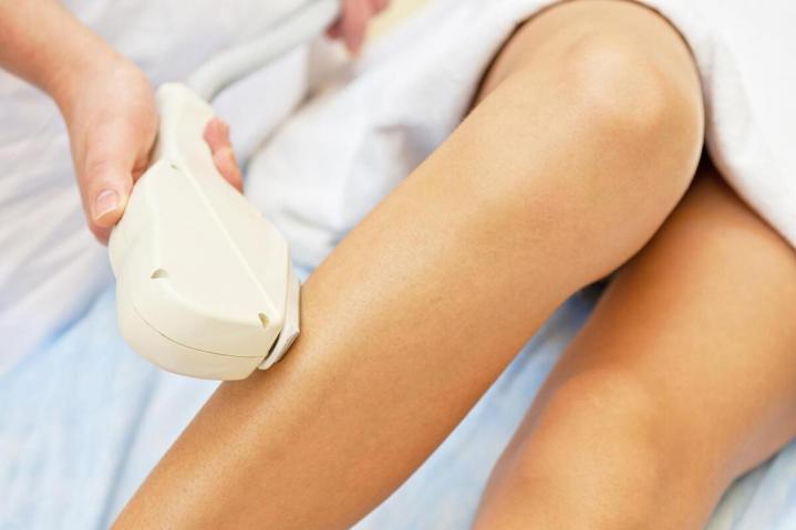 Varicose Vein Laser Treatments Laval
