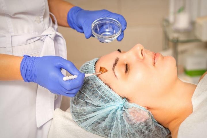 Glycolic Acid Treatment Laval