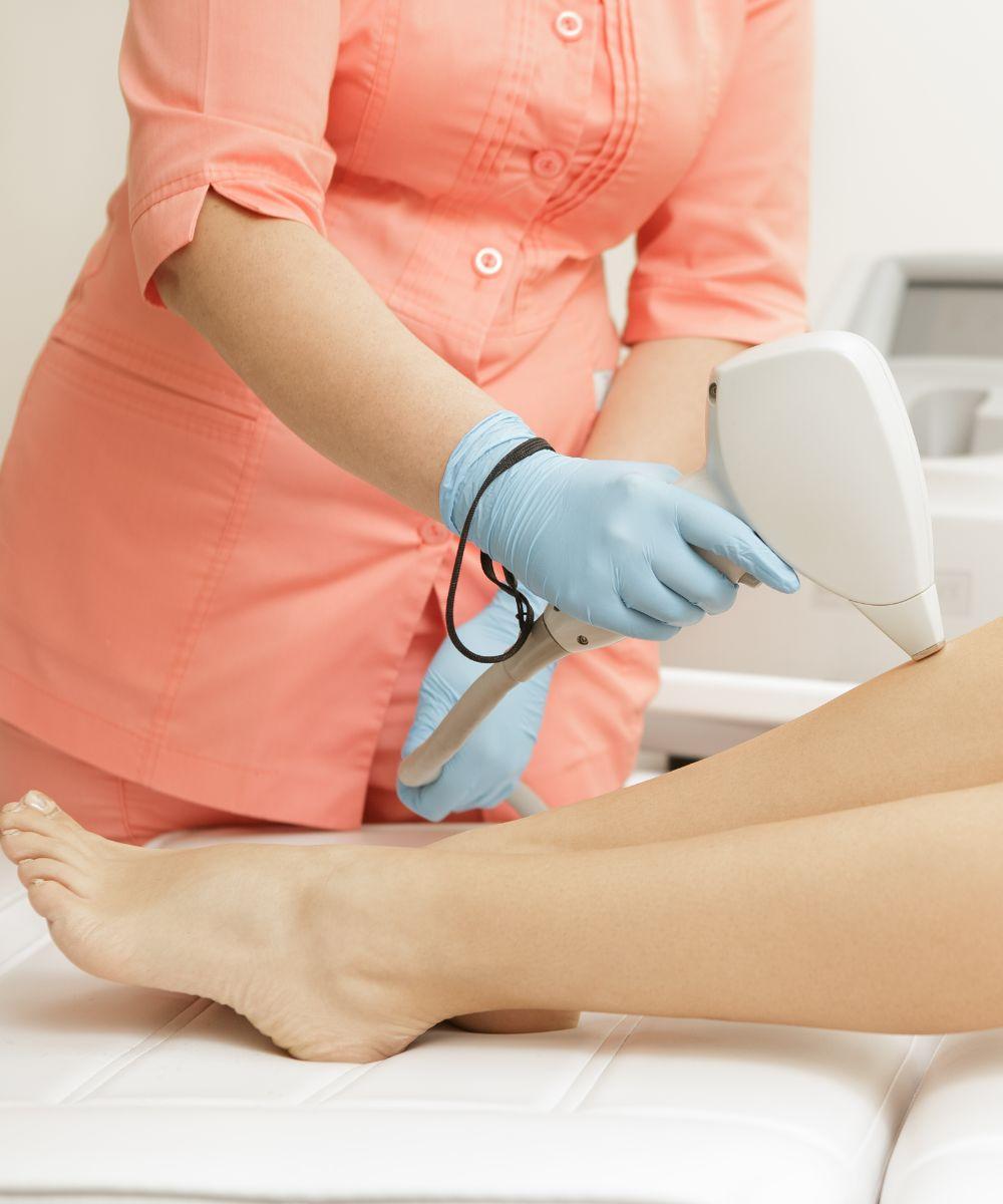 Varicose Vein Laser Clinic Laval